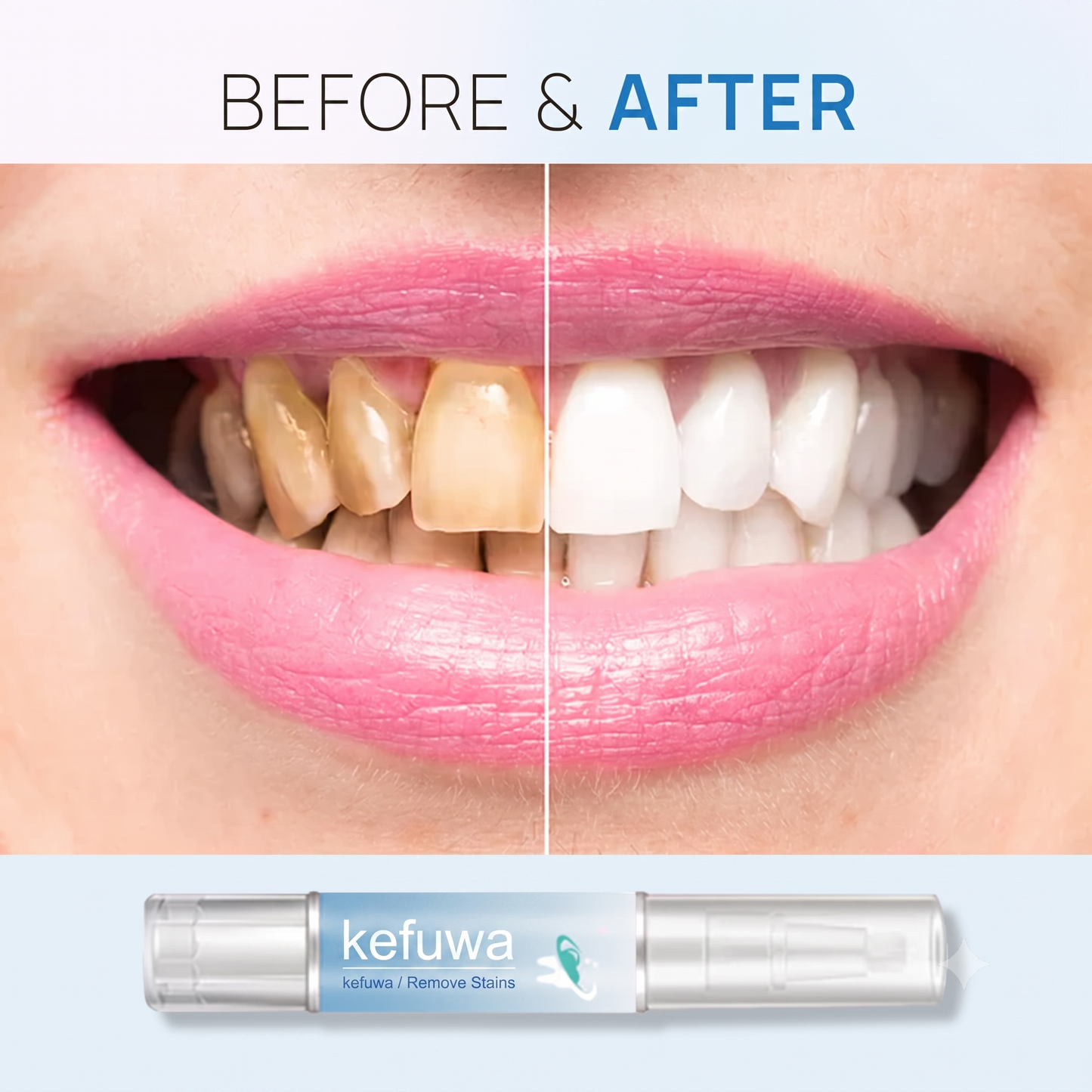 BUY 1 GET 1 FREE | Teeth Whitening Essence