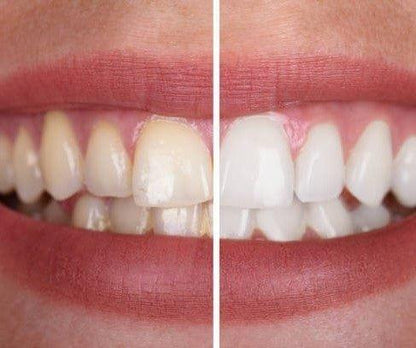 1+1 FREE I V34 Colour Corrector | Feel more confident with a fresh, radiant smile that lasts